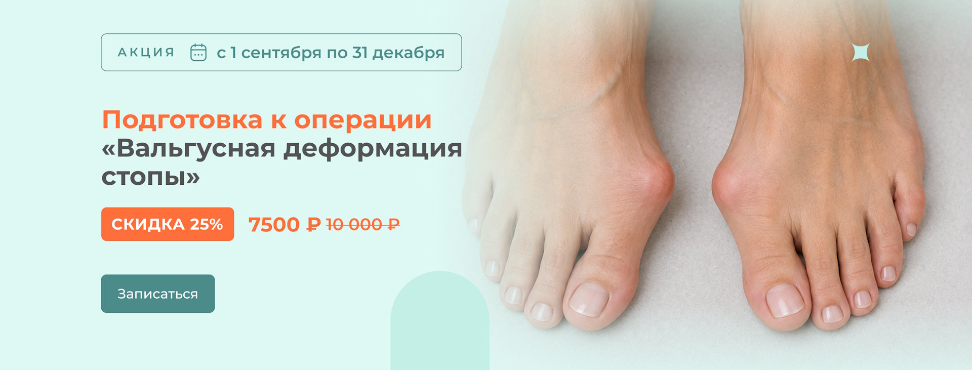 Вальгусная деформация стопы (Изображением)